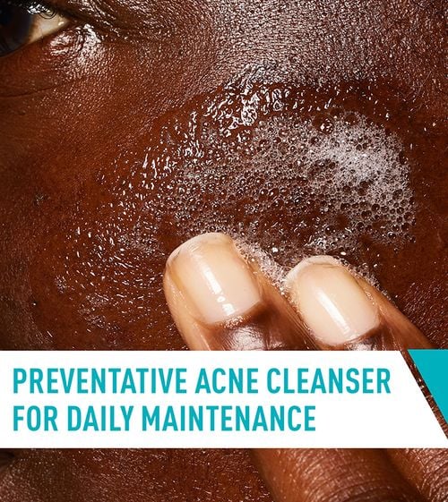 CeraVe Acne Control Cleanser - 237ml