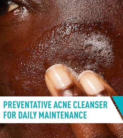 CeraVe Acne Control Cleanser - 237ml