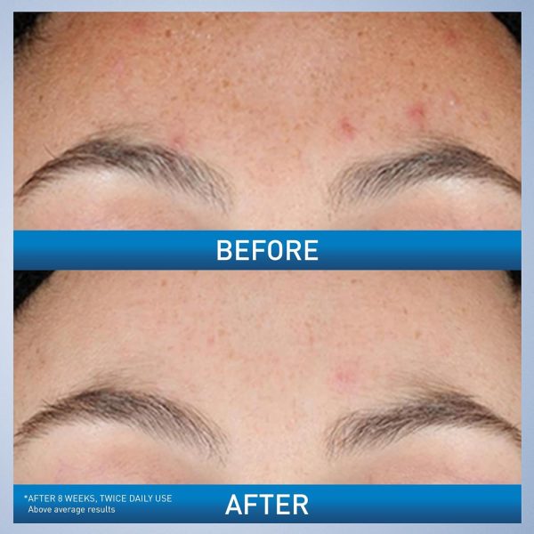 CeraVe Resurfacing Retinol Serum 30ml