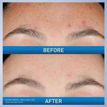 CeraVe Resurfacing Retinol Serum 30ml